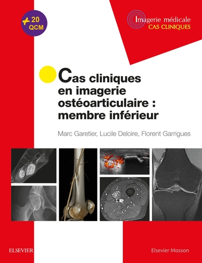 Cas Cliniques En Imagerie Ostéoarticulaire : Membre Inférieur, Membre Inferieur