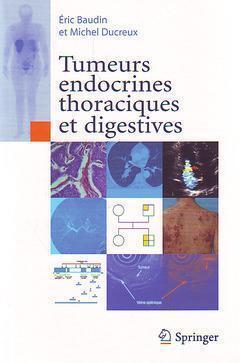 Tumeurs Endocrines Thoraciques Et Digestives - Michel Ducreux