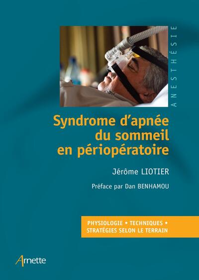 Syndrome d'apnée du sommeil en périopératoire