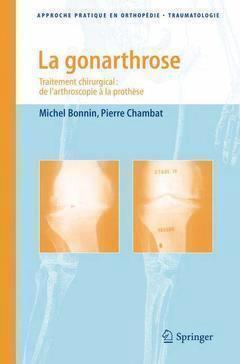 La Gonarthrose, Traitement Chirurgical