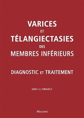 Varices et télangiectasies des membres inférieurs