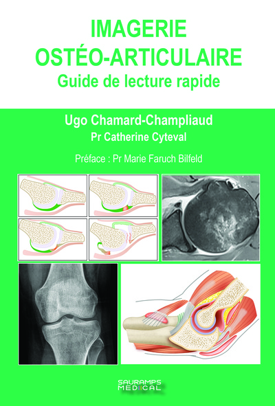 Imagerie ostéo-articulaire: Guide de lecture rapide - CATHERINE CYTEVAL