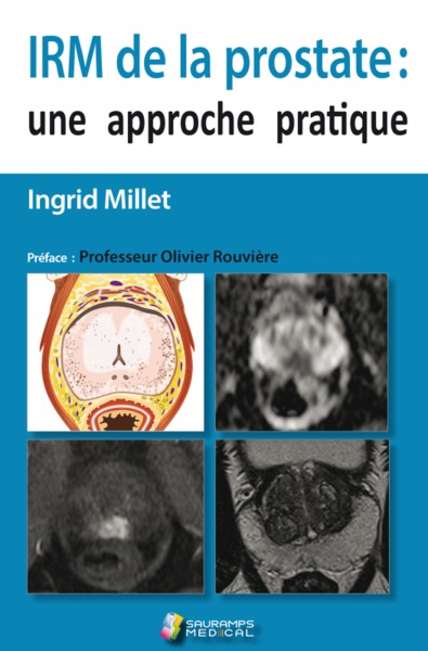 IRM de la prostate - Ingrid Millet-Cénac