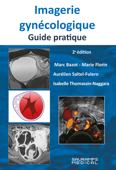 Imagerie gynécologique. Guide pratique 2ed - Isabelle Thomassin-Naggara