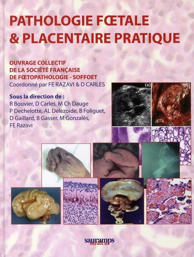 Pathologie foetale & placentaire pratique.