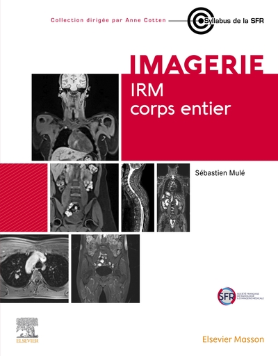 IRM corps entier - Sébastien Mulé