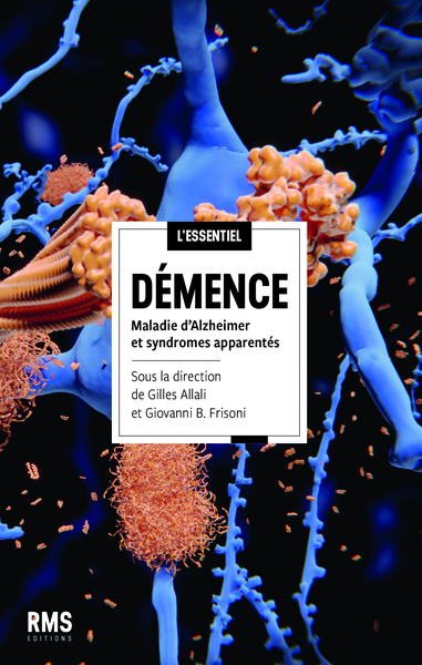 Demence : Maladie D Alzheimer Et Syndromes Apparentes.