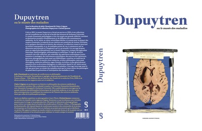 Dupuytren