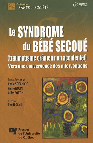 Le syndrome du bébé secoué (traumatisme crânien non accidentel)