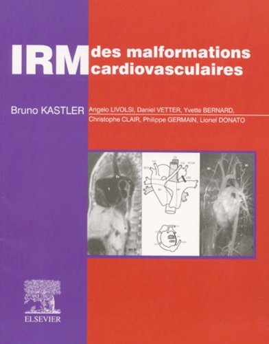 IRM des malformations cardiovasculaires