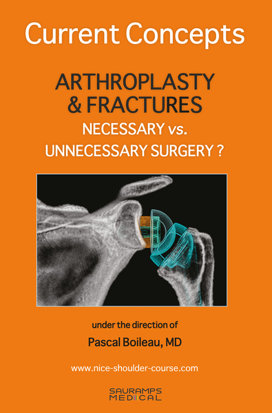 Current concepts. Arthroplasty & fractures necessary vs. unnecessary surgery ? - Pascal Boileau