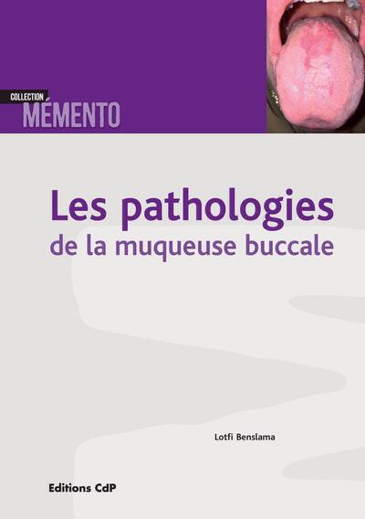 Les Pathologies De La Muqueuse Buccale