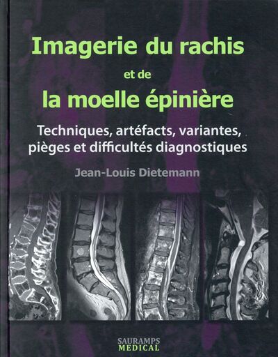 Imagerie du rachis et de la moelle épinière