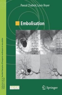 Embolisation