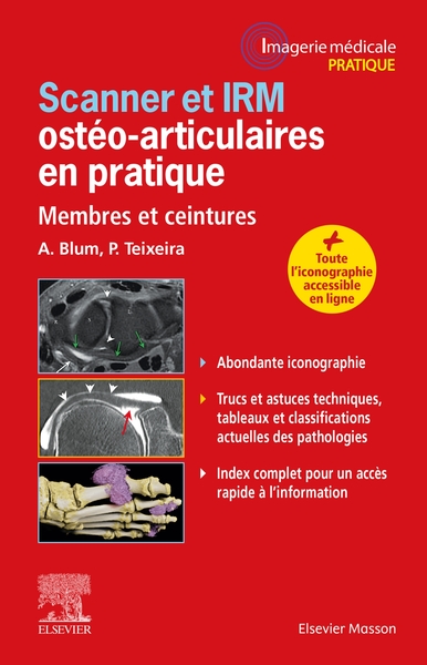 Scanner et IRM ostéo-articulaires en pratique - Alain Blum