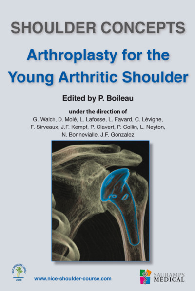 Arthroplasty for the young arthritic shoulder - Pascal Boileau