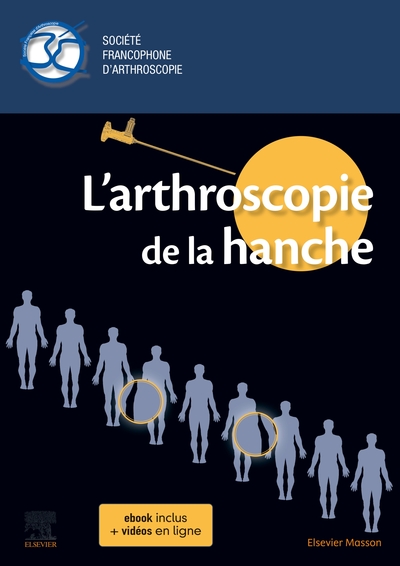 L'arthroscopie de la hanche