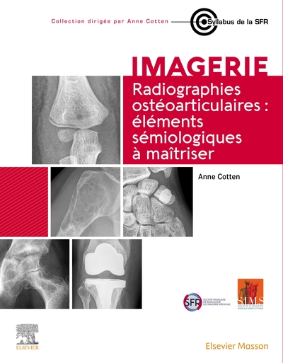 Radiographies ostéoarticulaires : éléments sémiologiques à maitriser