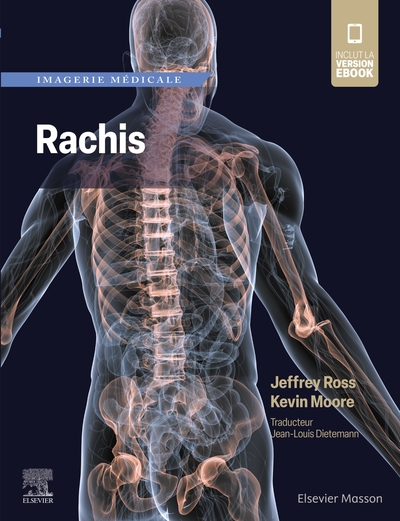 Imagerie médicale : Rachis