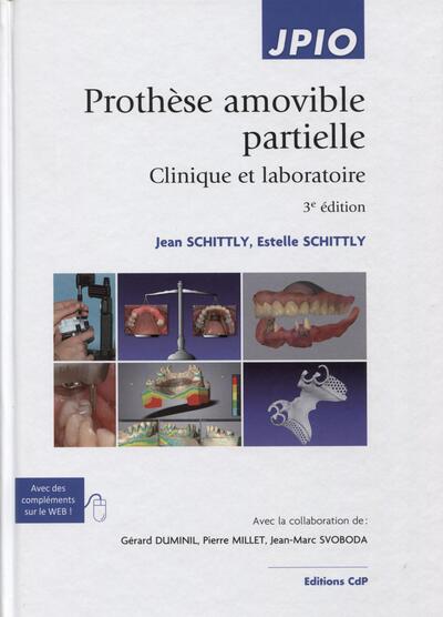 Prothèse amovible partielle