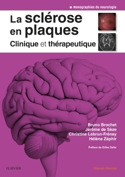 La sclérose en plaques - Clinique et thérapeutique