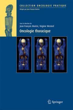 Oncologie thoracique - Virginie Westeel