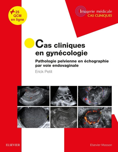 Cas Cliniques En Imagerie : Gynécologie, Pathologie Pelvienne En Échographie Par Voie Endovaginale