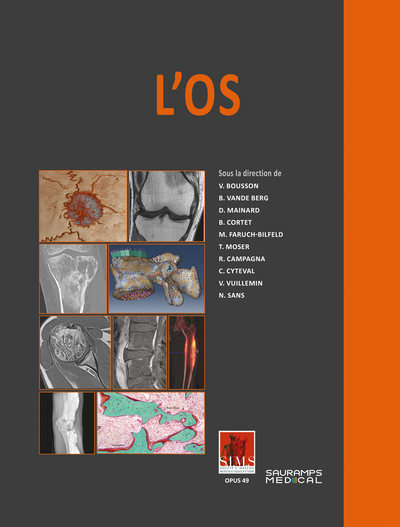 L'os - SIMS - V Bousson, Sims