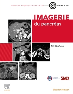 Imagerie du pancréas - Professeur Mathilde Wagner