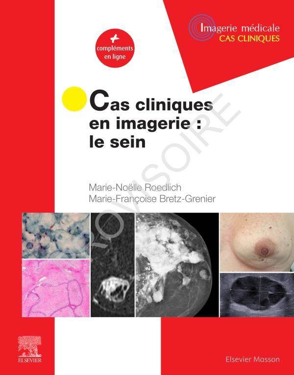 Cas cliniques en imagerie : le sein