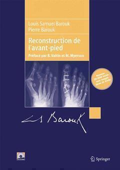 Reconstruction de l'avant-pied - Louis Samuel Barouk