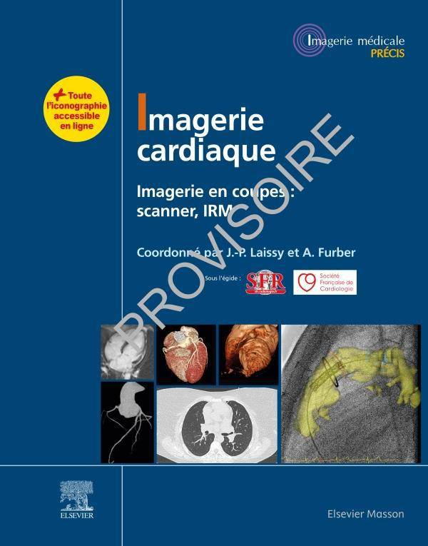 Imagerie cardiaque