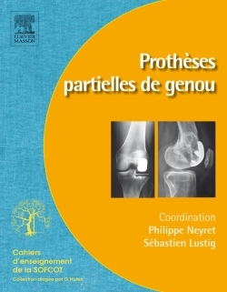 Prothèses partielles de genou