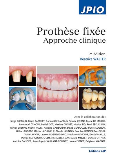 Prothèse fixée, 2e Ed.