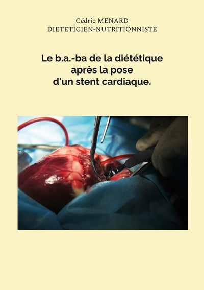 Le b.a.-ba de la diététique après la pose d'un stent cardiaque. - Cédric Ménard