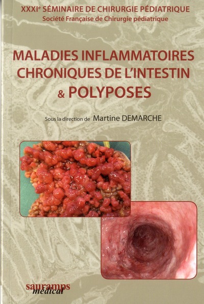 Maladies inflammatoires chroniques de l'intestin & polyposes - Martine Demarche