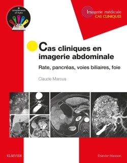 Cas cliniques en imagerie abdominale - Professeur Claude Marcus