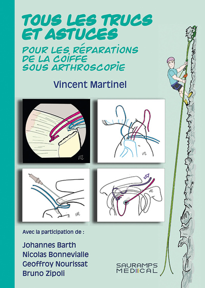 Tous Les Trucs Et Astuces Pour Les Réparations De La Coiffe Sous Arthroscopie