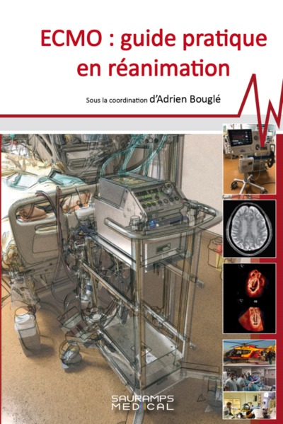 ECMO : Guide pratique en réanimation