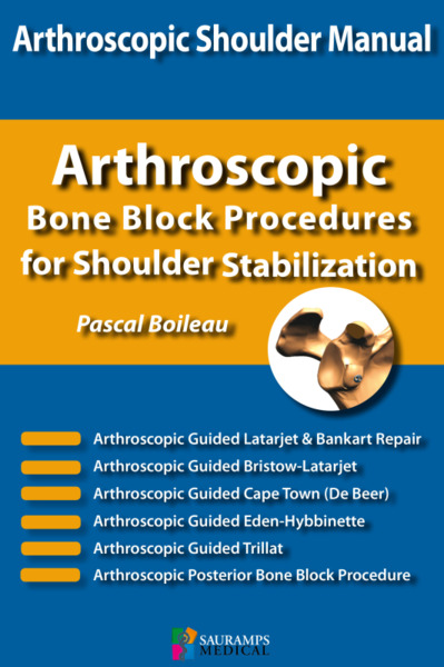 Arthroscopic shoulder manual