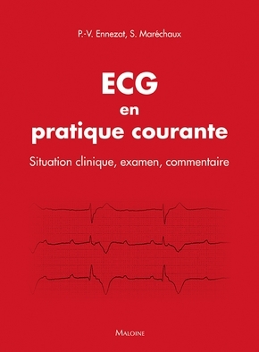 L'Ecg En Pratique Courante, Situation Clinique, Examen, Commentaire