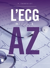 L'ECG de A à Z