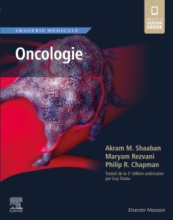 Imagerie médicale : Oncologie - Akram M. Shaaban