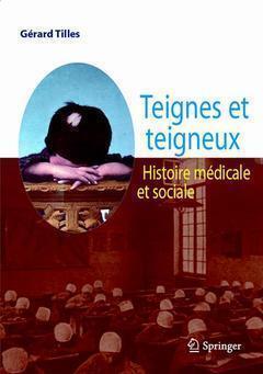 Teignes Et Teigneux, Histoire Médicale Et Sociale