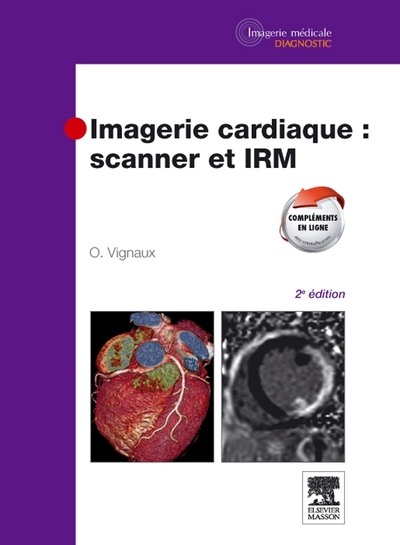 Imagerie cardiaque : scanner et IRM