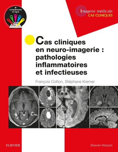 Cas Cliniques En Neuro-Imagerie : Pathologies Inflammatoires Et Infectieuses, Path Inflammat Et Infectieuses - Professeur François Cotton, Professeur Stéphane Kremer