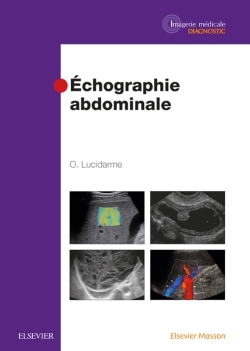 Echographie abdominale