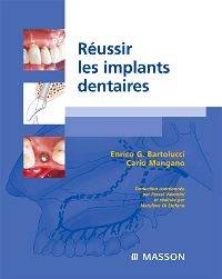 Réussir les implants dentaires