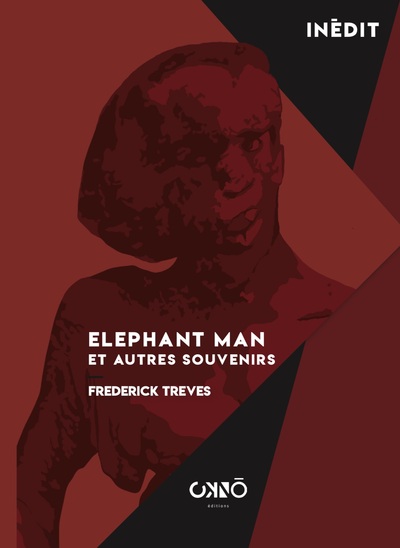 Elephant man et autres souvenirs - Frederick Treves