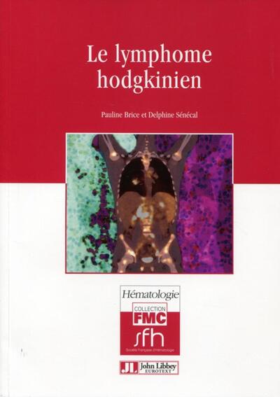 Le lymphome hodgkinien